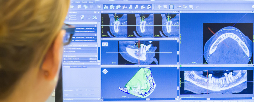 Einsatz des Programms Codiagnostix für eine moderne zahnchirurgische Behandlung