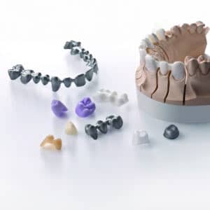 Verschiedene Zahnabdruck-Modelle